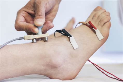 testing nerve conduction velocioty for drop foot|mrc scale for foot drop.